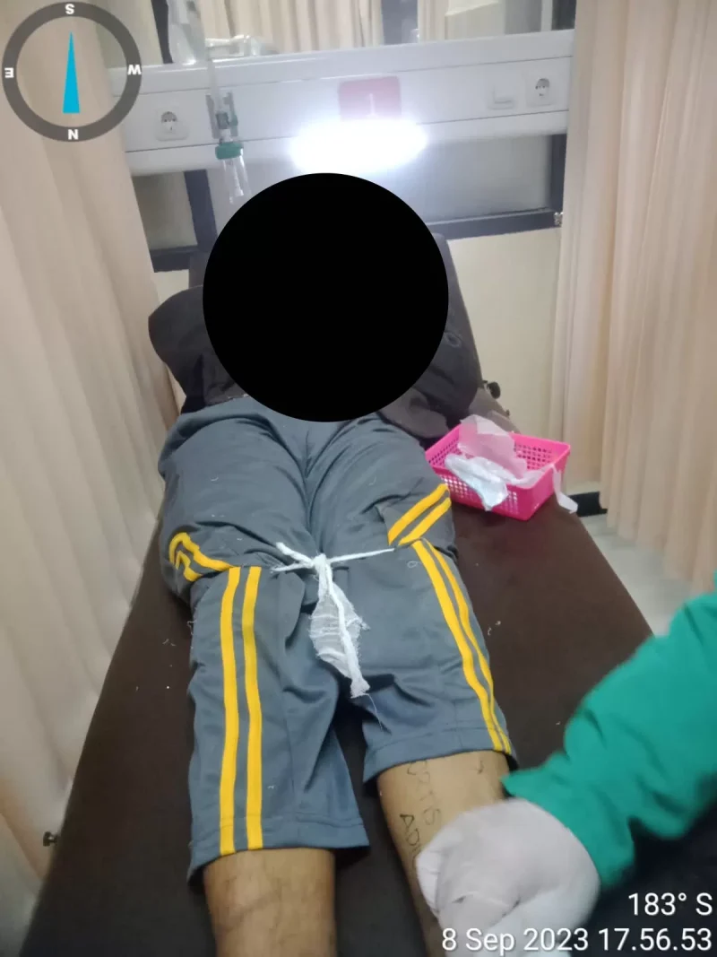 Korban pengeroyokan sekelompok pelajar. (Foto.ist)